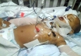 نجات معجزه آسای یک نوزاد پس از سقوط از طبقه یازدهم + تصاویر