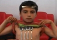 خاصیت آهن‌ربایی در بدن یک نوجوان 10 ساله + فیلم