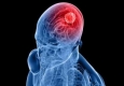 نقش افکار در رشد یک نوع تومور مغزی