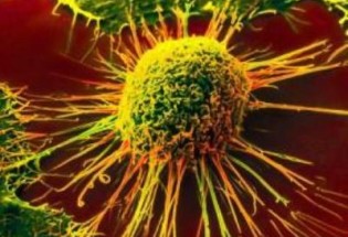 نتایج موفقیت آمیز مطالعات محققان ایرانی برای درمان سه نوع سرطان