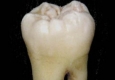 با طب باستانی هندوها دندانهایتان را سفید کنید