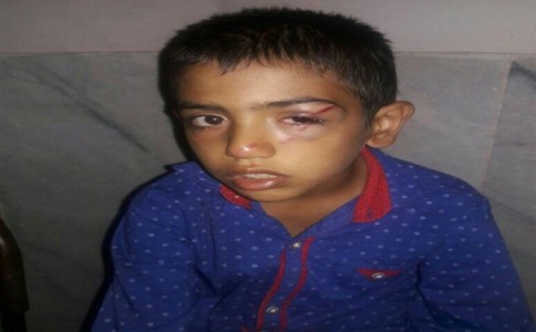 ضرب و شتم با کمربند دانش آموز فهرجی را نابیناکرد / خشونت در مدارس کرمان ادامه دارد