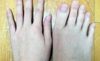 دختر تایوانی بلندترین انگشتان پا در جهان را دارد +تصاویر