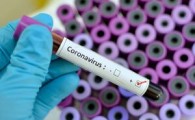 ژاپن ویروس کرونا را در آزمایشگاه ساخت