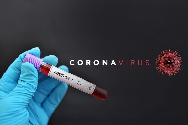تاکنون هیچ موردی از ابتلا دام‌ ها به ویروس کرونا نداشته ایم/شهروندان باید نکات بهداشتی را رعایت کنند
