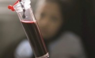 بیماران تالاسمی ایرانشهری چشم انتظار فرآورده های خونی هستند